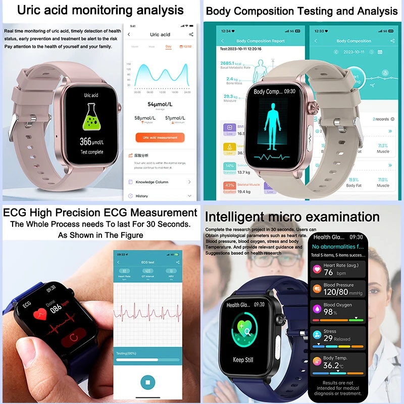 2025 New For XIAOM1 ECG+PPG Bl - Smartwatch Health Watches For Women avis et prix